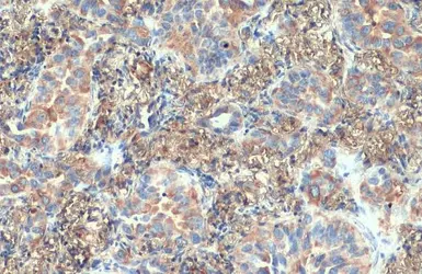 Anti-VPS35 antibody [HL1017] used in IHC (Paraffin sections) (IHC-P). GTX635821