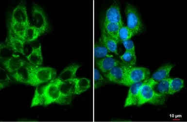 Anti-Anterior Gradient 2 antibody [HL1024] used in Immunocytochemistry/ Immunofluorescence (ICC/IF). GTX635838