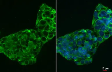 Anti-CTGF antibody [GT28711] used in Immunocytochemistry/ Immunofluorescence (ICC/IF). GTX635865