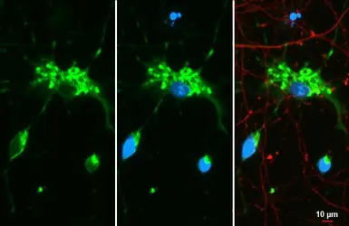Anti-Myelin basic protein antibody [HL1033] used in Immunocytochemistry/ Immunofluorescence (ICC/IF). GTX635873