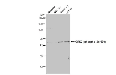 Anti-GRK2 (phospho Ser670) antibody [HL1035] used in Western Blot (WB). GTX635875