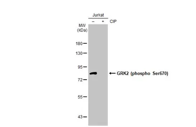 Anti-GRK2 (phospho Ser670) antibody [HL1035] used in Western Blot (WB). GTX635875