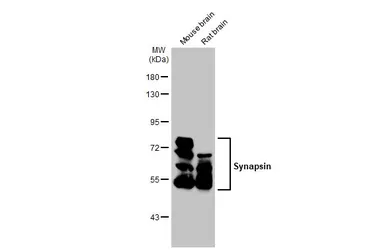 Anti-Synapsin antibody [GT965] used in Western Blot (WB). GTX635885