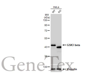 Anti-GSK3 beta antibody [GT1619] used in Western Blot (WB). GTX635886