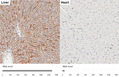 Anti-Apolipoprotein E antibody [GT27711] used in IHC (Paraffin sections) (IHC-P). GTX635889