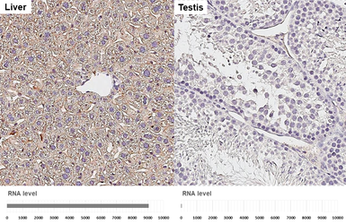 Anti-Apolipoprotein E antibody [GT27711] used in IHC (Paraffin sections) (IHC-P). GTX635889