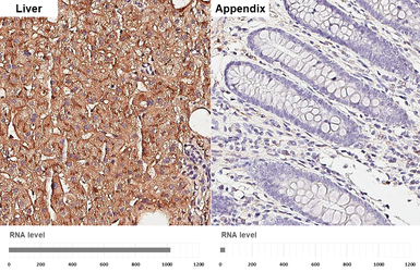 Anti-Apolipoprotein E antibody [GT27711] used in IHC (Paraffin sections) (IHC-P). GTX635889