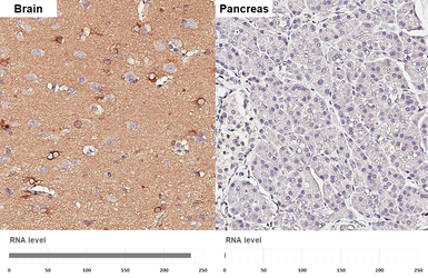 Anti-Apolipoprotein E antibody [GT27711] used in IHC (Paraffin sections) (IHC-P). GTX635889