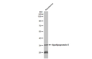 Anti-Apolipoprotein E antibody [GT1627] used in Western Blot (WB). GTX635891