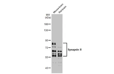 Anti-Synapsin II antibody [GT1446] used in Western Blot (WB). GTX635894