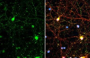 Anti-Synapsin II antibody [GT1446] used in Immunocytochemistry/ Immunofluorescence (ICC/IF). GTX635894