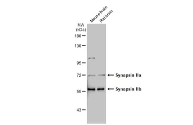Anti-Synapsin II antibody [GT763] used in Western Blot (WB). GTX635896