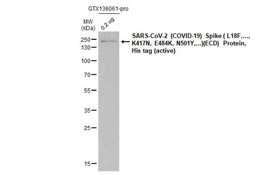 Anti-SARS-CoV-2 (COVID-19) Spike S2 antibody [HL1038] used in Western Blot (WB). GTX635910