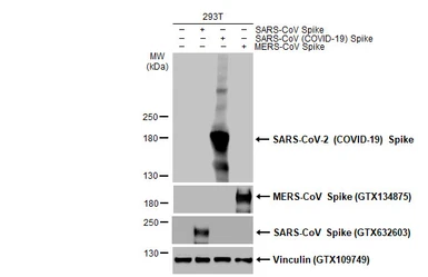 Anti-SARS-CoV-2 (COVID-19) Spike S2 antibody [HL1038] used in Western Blot (WB). GTX635910