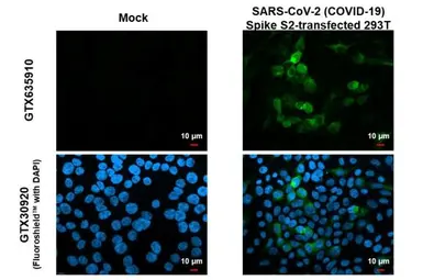 Anti-SARS-CoV-2 (COVID-19) Spike S2 antibody [HL1038] used in Immunocytochemistry/ Immunofluorescence (ICC/IF). GTX635910