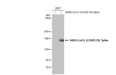 Anti-SARS-CoV-2 (COVID-19) Spike S2 antibody [HL1038] used in Western Blot (WB). GTX635910