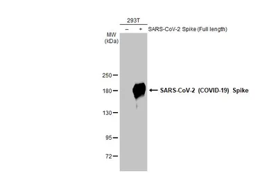 Anti-SARS-CoV-2 (COVID-19) Spike S2 / S2' antibody [HL1039] used in Western Blot (WB). GTX635911