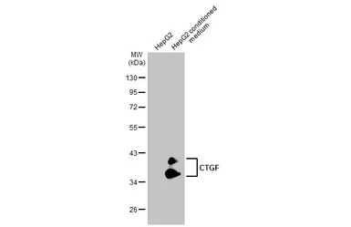 Anti-CTGF antibody [GT1116] used in Western Blot (WB). GTX635971
