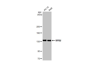 Anti-RPB2 antibody [HL1042] used in Western Blot (WB). GTX635976