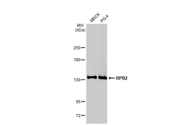 Anti-RPB2 antibody [HL1042] used in Western Blot (WB). GTX635976
