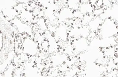 Anti-RPB2 antibody [HL1042] used in IHC (Paraffin sections) (IHC-P). GTX635976