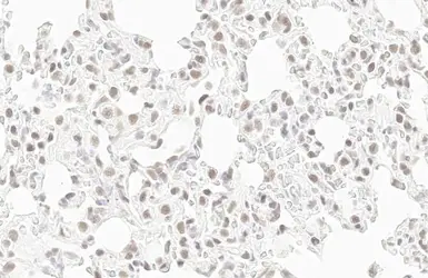 Anti-RPB2 antibody [HL1042] used in IHC (Paraffin sections) (IHC-P). GTX635976