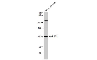 Anti-RPB2 antibody [HL1043] used in Western Blot (WB). GTX635977