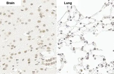 Anti-RPB2 antibody [HL1043] used in IHC (Paraffin sections) (IHC-P). GTX635977