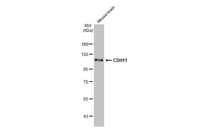 Anti-CDH11 antibody [HL1044] used in Western Blot (WB). GTX635978