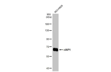 Anti-cIAP1 antibody [HL1045] used in Western Blot (WB). GTX635979