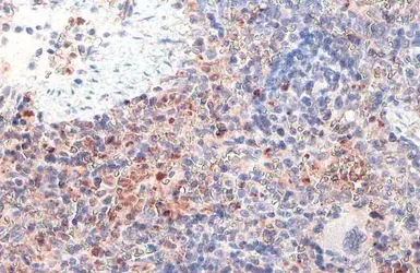 Anti-cIAP1 antibody [HL1045] used in IHC (Paraffin sections) (IHC-P). GTX635979