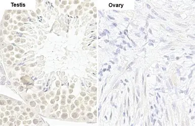 Anti-cIAP1 antibody [HL1045] used in IHC (Paraffin sections) (IHC-P). GTX635979