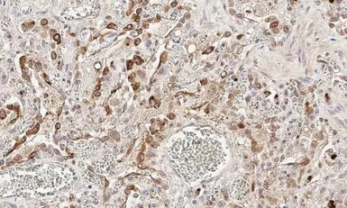 Anti-cIAP1 antibody [HL1045] used in IHC (Paraffin sections) (IHC-P). GTX635979