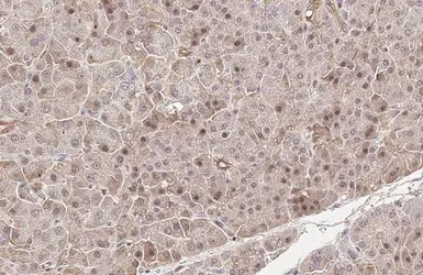 Anti-cIAP1 antibody [HL1045] used in IHC (Paraffin sections) (IHC-P). GTX635979