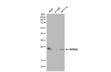 Anti-RAB6A antibody [HL1047] used in Western Blot (WB). GTX635981