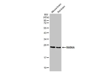 Anti-RAB6A antibody [HL1047] used in Western Blot (WB). GTX635981
