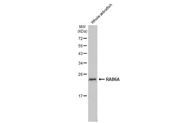 Anti-RAB6A antibody [HL1047] used in Western Blot (WB). GTX635981