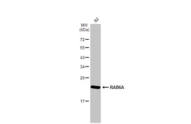 Anti-RAB6A antibody [HL1047] used in Western Blot (WB). GTX635981