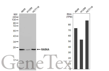 Anti-RAB6A antibody [HL1047] used in Western Blot (WB). GTX635981