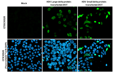 Anti-Hepatitis D virus Large delta + Small delta protein antibody [HL1053] used in Immunocytochemistry/ Immunofluorescence (ICC/IF). GTX636028