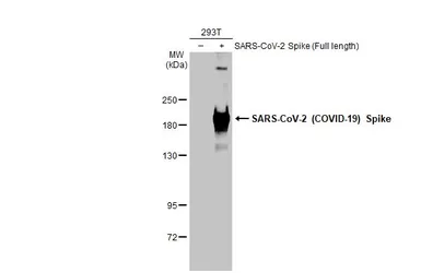 Anti-SARS-CoV-2 (COVID-19) Spike S2 antibody [GT745] used in Western Blot (WB). GTX636037