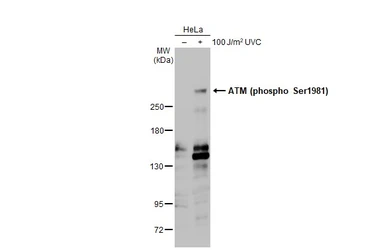 Anti-ATM (phospho Ser1981) antibody [HL1062] used in Western Blot (WB). GTX636086