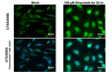 Anti-ATM (phospho Ser1981) antibody [HL1062] used in Immunocytochemistry/ Immunofluorescence (ICC/IF). GTX636086