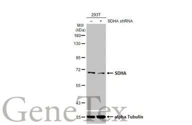 Anti-SDHA antibody [HL1067] used in Western Blot (WB). GTX636098