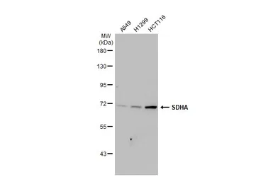 Anti-SDHA antibody [HL1067] used in Western Blot (WB). GTX636098