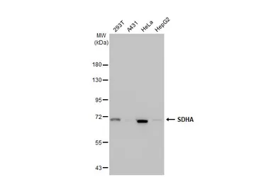 Anti-SDHA antibody [HL1067] used in Western Blot (WB). GTX636098