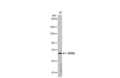 Anti-SDHA antibody [HL1067] used in Western Blot (WB). GTX636098
