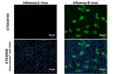 Anti-Influenza B virus Nucleoprotein antibody [HL1069] used in Immunocytochemistry/ Immunofluorescence (ICC/IF). GTX636100