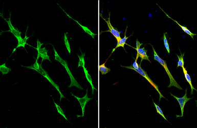 Anti-SARM1 antibody [HL1070] used in Immunocytochemistry/ Immunofluorescence (ICC/IF). GTX636102
