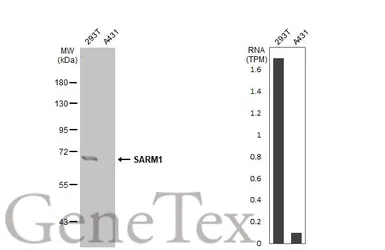 Anti-SARM1 antibody [HL1070] used in Western Blot (WB). GTX636102